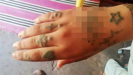 Подонки месяц насиловали 17-летнюю девушку, изуродовав её тело тату со свастикой