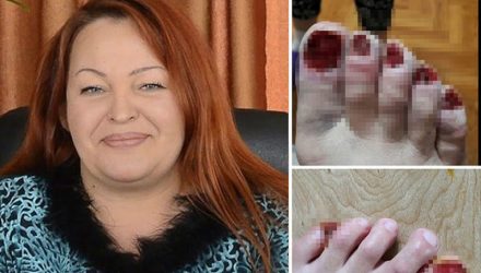 Не педикюрша, а мясник. Горе-мастер отрывает клиенткам ногти, "исцеляя" от рака