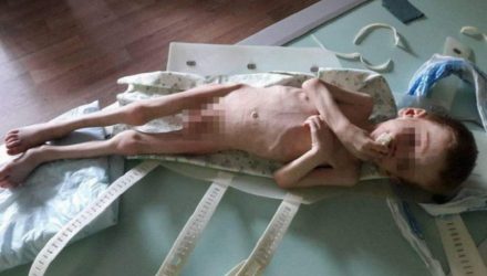 Волосы дыбом. В Украине родители заморили голодом 4-летнего сына‍ – он лежал весь в фекалиях
