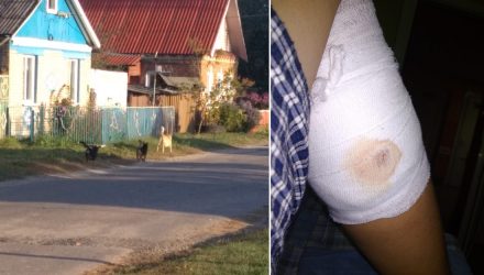 В Чечерске стая бездомных собак покусала 10-летнего мальчика, который шёл в школу
