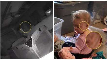 Родители ужаснулись, когда посмотрели видео с камеры и узнали, кто оцарапал дочь