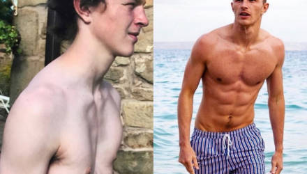 13 лет с железом в рёбрах. Как парень с впалой грудью стал моделью Calvin Klein