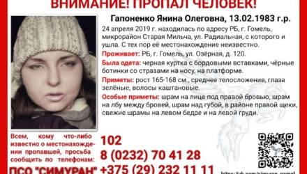 В Гомеле пропала женщина со шрамами на лице. Ищут уже второй месяц