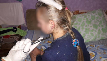 В Гомеле у 12-летней девочки застряла серёжка в ухе. Понадобилась помощь спасателей