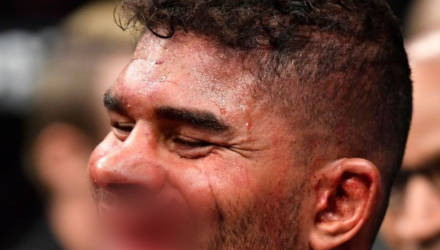 Звезде UFC во время нокаута "оторвали" часть губы