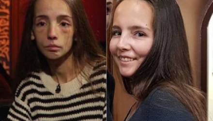 Звезда «Битвы экстрасенсов» победила анорексию и стала красавицей