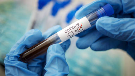 Выписанный из гомельской больницы пациент, переболевший COVID-19, рассказал о симптомах болезни и самочувствии