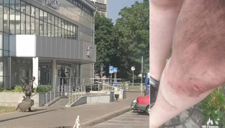 В Гомеле девушка провалилась в люк: скорая отказалась ехать, а милиция посоветовала обратиться в суд