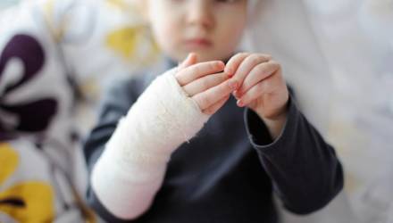В Гомеле 2-летний малыш попал в реанимацию после того, как на него упала чашка с горячим чаем