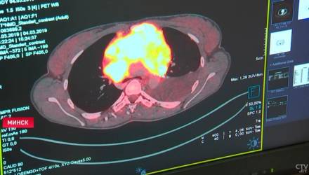 Гомельские айтишники создали программу для выявления рака молочной железы у женщин