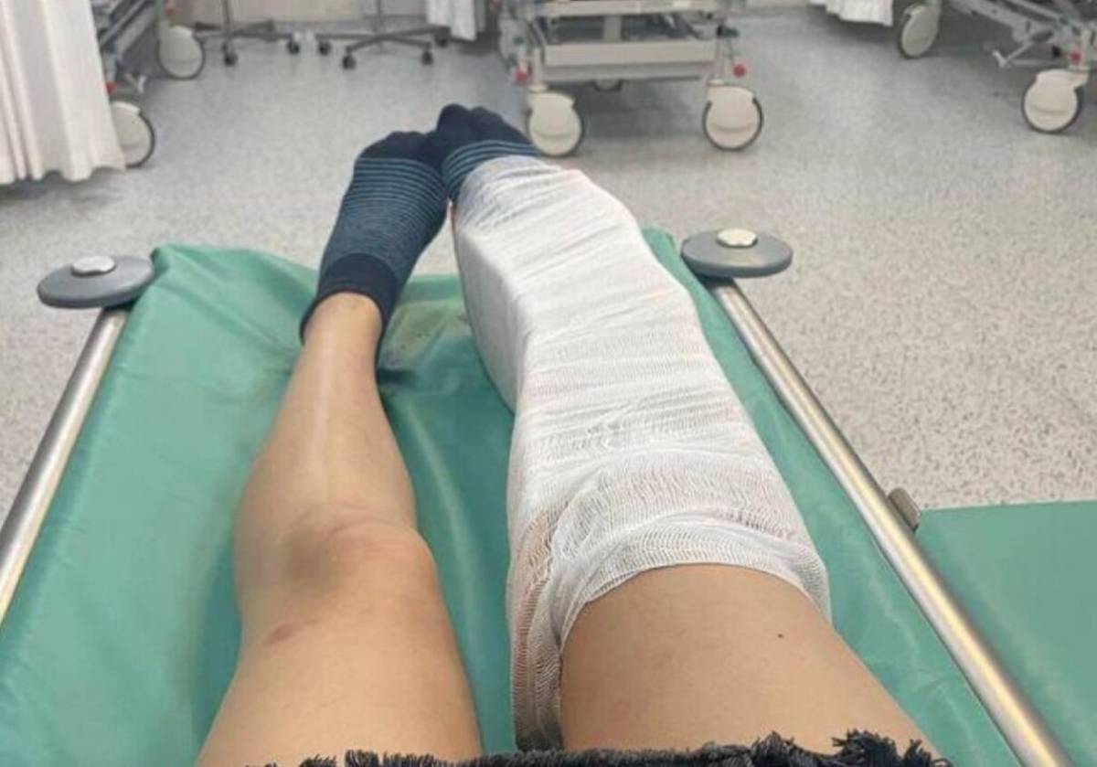 Гомельчанка отсудила у горисполкома 15 тысяч рублей за травму на пляже