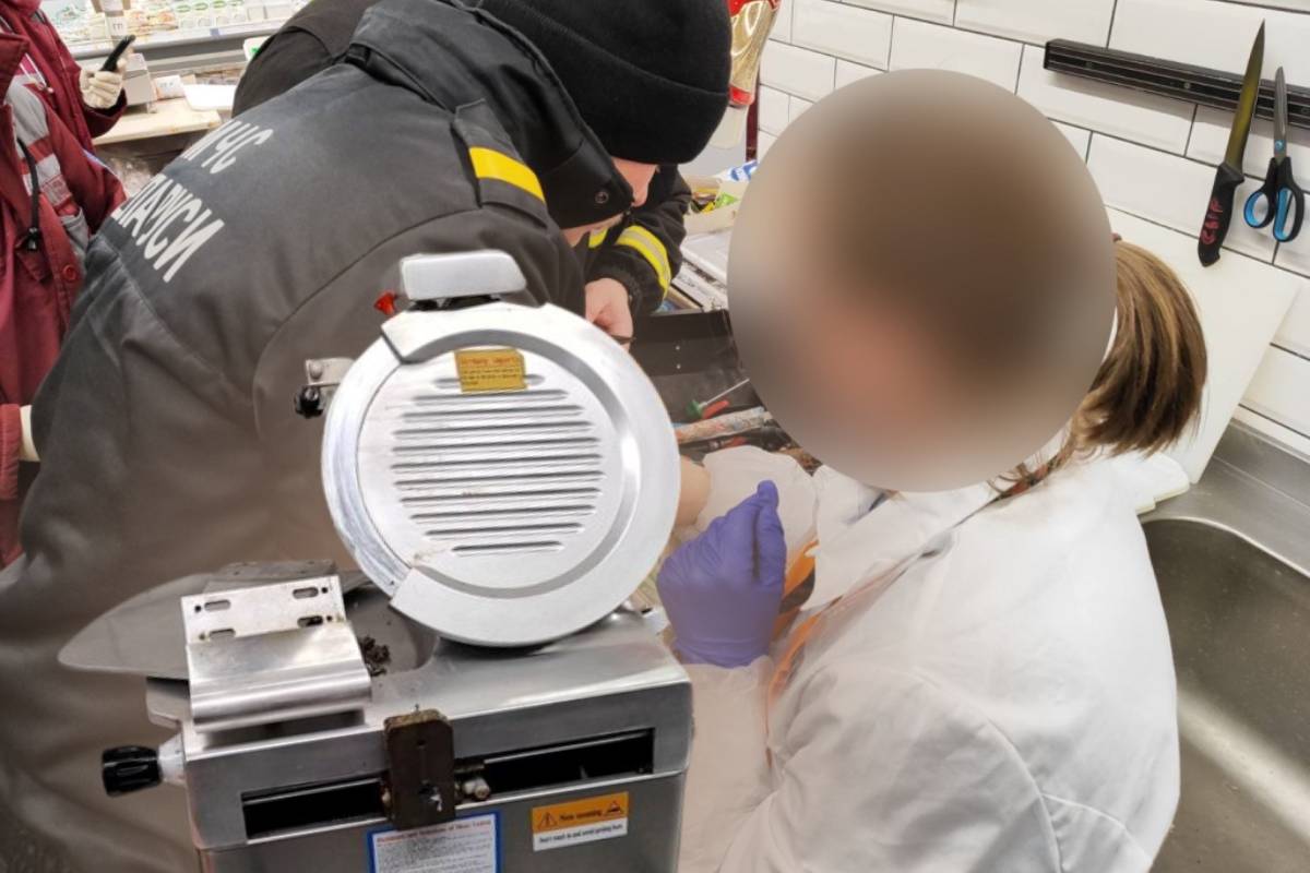 В Гомеле спасатели ночью освободили палец женщины из слайсера