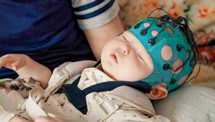 Центры пароксизмальных состояний